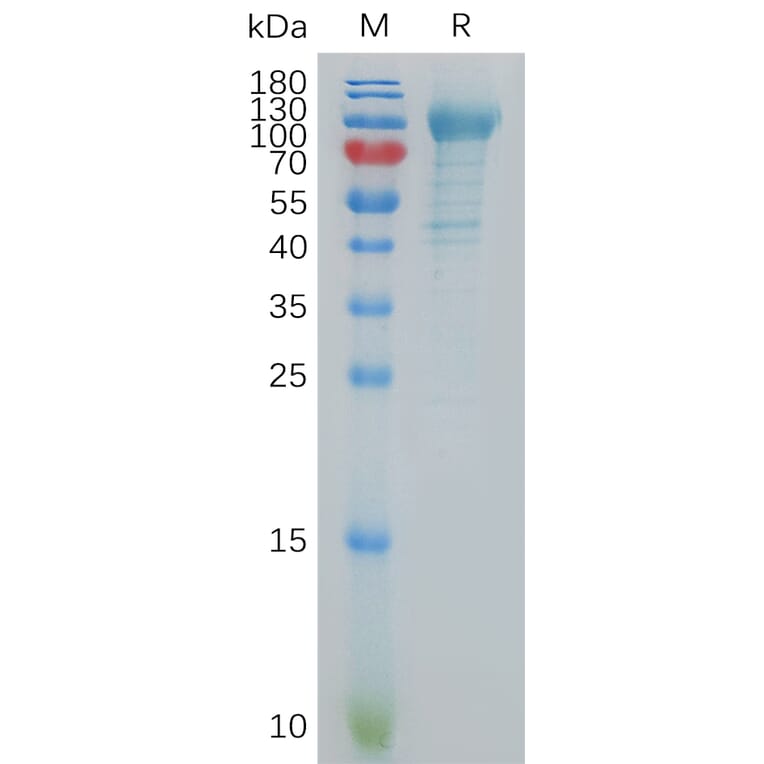 SDS-PAGE - Recombinant Human K Cadherin/CDH6 Protein (6×His Tag) (A317854) - Antibodies.com