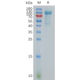 SDS-PAGE - Recombinant Human K Cadherin/CDH6 Protein (6×His Tag) (A317854) - Antibodies.com