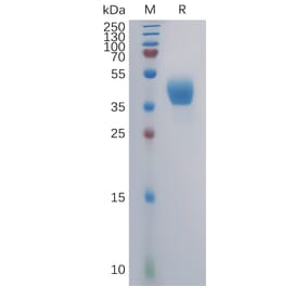 SDS-PAGE - Recombinant Human CCR2 Protein (Fc Tag) (A317856) - Antibodies.com