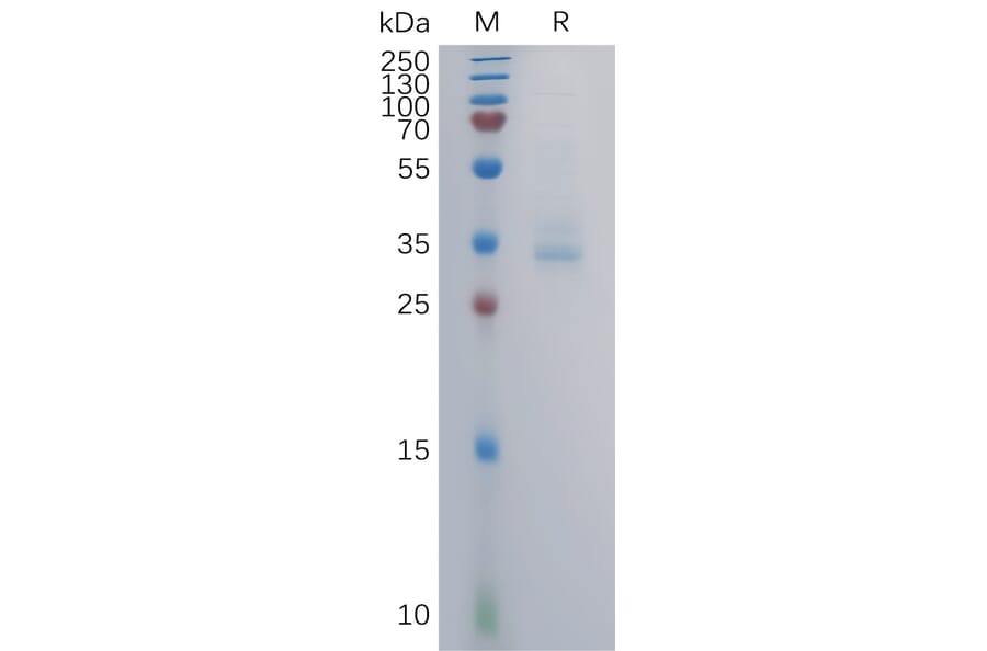 SDS-PAGE - Recombinant Human GPCR GPRC5B Protein (Fc Tag) (A317858) - Antibodies.com