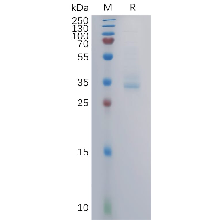 SDS-PAGE - Recombinant Human GPCR GPRC5B Protein (Fc Tag) (A317858) - Antibodies.com