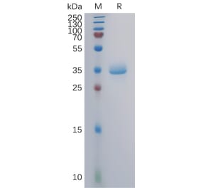 SDS-PAGE - Recombinant Human GPRC5A Protein (Fc Tag) (A317859) - Antibodies.com