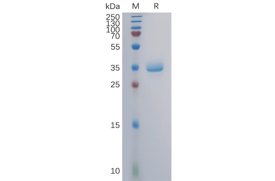 SDS-PAGE - Recombinant Human GPRC5A Protein (Fc Tag) (A317859) - Antibodies.com
