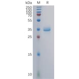 SDS-PAGE - Recombinant Human GPRC5A Protein (Fc Tag) (A317859) - Antibodies.com