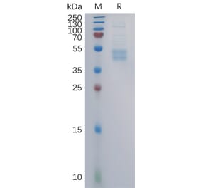 SDS-PAGE - Recombinant Human CCR6 Protein (Fc Tag) (A317860) - Antibodies.com