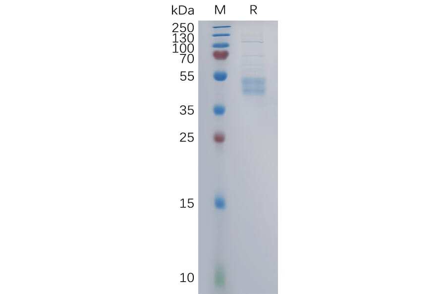 SDS-PAGE - Recombinant Human CCR6 Protein (Fc Tag) (A317860) - Antibodies.com