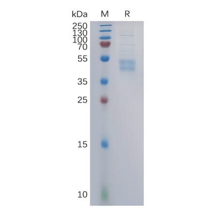 SDS-PAGE - Recombinant Human CCR6 Protein (Fc Tag) (A317860) - Antibodies.com