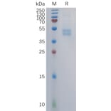 SDS-PAGE - Recombinant Human CCR6 Protein (Fc Tag) (A317860) - Antibodies.com