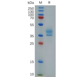 SDS-PAGE - Recombinant Human CCR8 Protein (Fc Tag) (A317861) - Antibodies.com