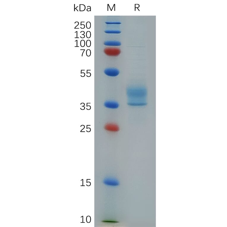 SDS-PAGE - Recombinant Human CCR8 Protein (Fc Tag) (A317861) - Antibodies.com