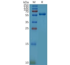 SDS-PAGE - Recombinant Human CD32a Protein (R167 variant) (Fc Tag) (A317862) - Antibodies.com