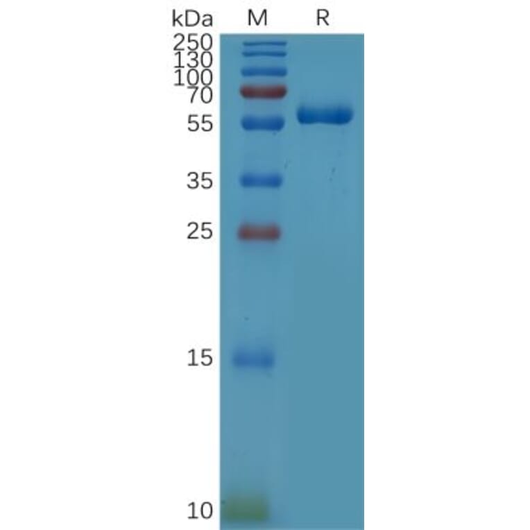 SDS-PAGE - Recombinant Human CD32a Protein (R167 variant) (Fc Tag) (A317862) - Antibodies.com