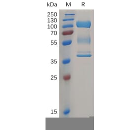 SDS-PAGE - Recombinant Human ZP3 Protein (Fc Tag) (A317863) - Antibodies.com