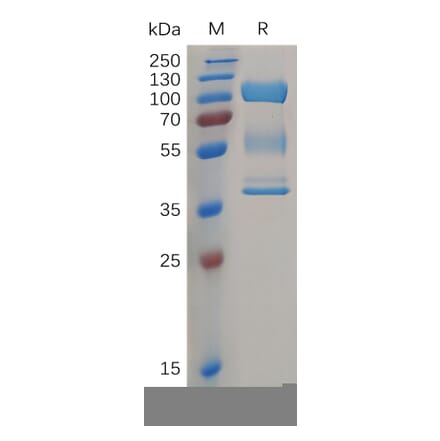 SDS-PAGE - Recombinant Human ZP3 Protein (Fc Tag) (A317863) - Antibodies.com
