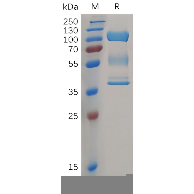 SDS-PAGE - Recombinant Human ZP3 Protein (Fc Tag) (A317863) - Antibodies.com