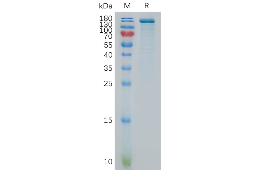 SDS-PAGE - Recombinant Human ENPP3/B10 Protein (Fc Tag) (A317864) - Antibodies.com