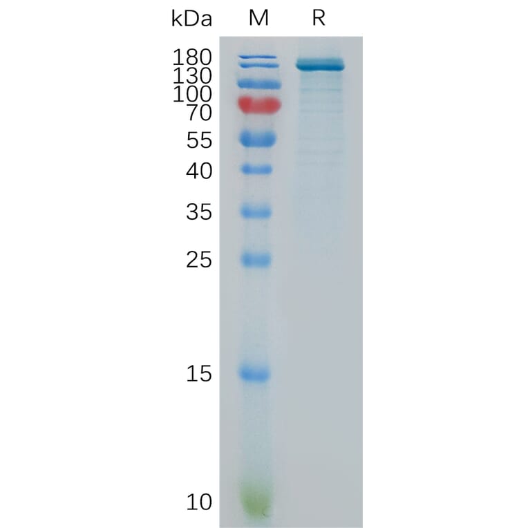 SDS-PAGE - Recombinant Human ENPP3/B10 Protein (Fc Tag) (A317864) - Antibodies.com
