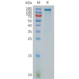 SDS-PAGE - Recombinant Human ENPP3/B10 Protein (Fc Tag) (A317864) - Antibodies.com