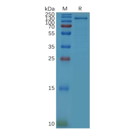 SDS-PAGE - Recombinant Human HGF Protein (Fc Tag) (A317866) - Antibodies.com