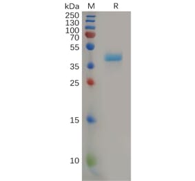 SDS-PAGE - Recombinant Human CCR8 Protein (Fc Tag) (A317867) - Antibodies.com