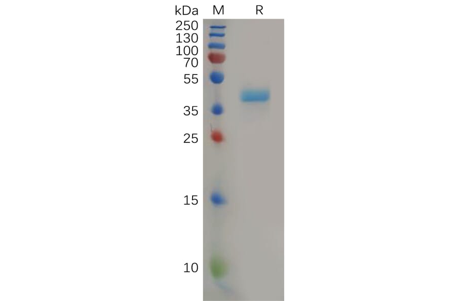 SDS-PAGE - Recombinant Human CCR8 Protein (Fc Tag) (A317867) - Antibodies.com