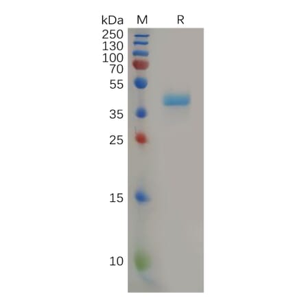 SDS-PAGE - Recombinant Human CCR8 Protein (Fc Tag) (A317867) - Antibodies.com