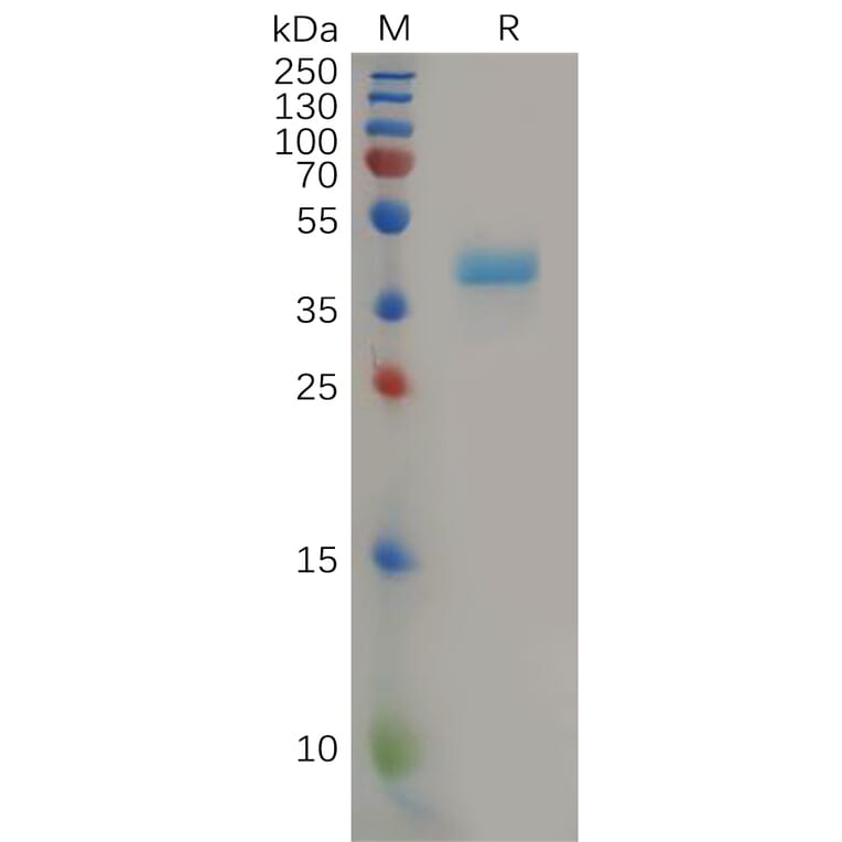SDS-PAGE - Recombinant Human CCR8 Protein (Fc Tag) (A317867) - Antibodies.com