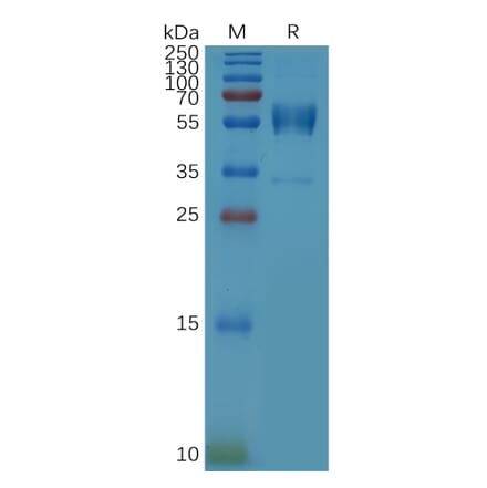 SDS-PAGE - Recombinant Human CD79b Protein (Fc Tag) (A317868) - Antibodies.com