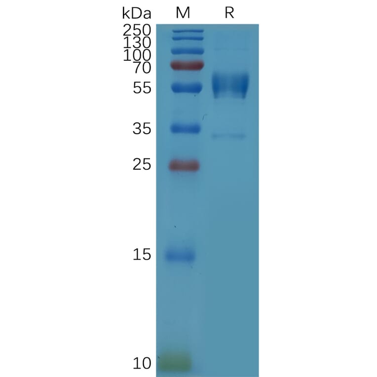 SDS-PAGE - Recombinant Human CD79b Protein (Fc Tag) (A317868) - Antibodies.com