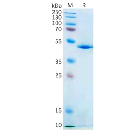 SDS-PAGE - Recombinant Human IL-21 Protein (Fc Tag) (A317869) - Antibodies.com