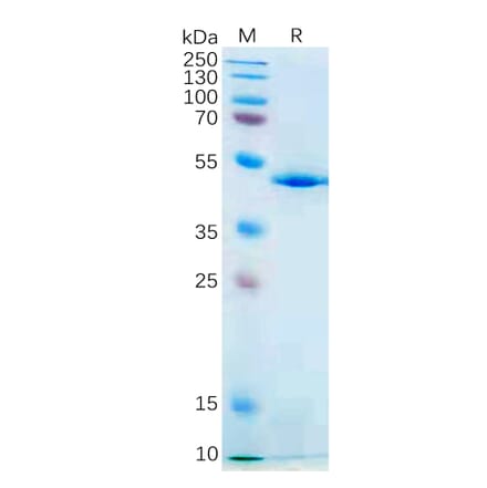 SDS-PAGE - Recombinant Human IL-21 Protein (Fc Tag) (A317869) - Antibodies.com