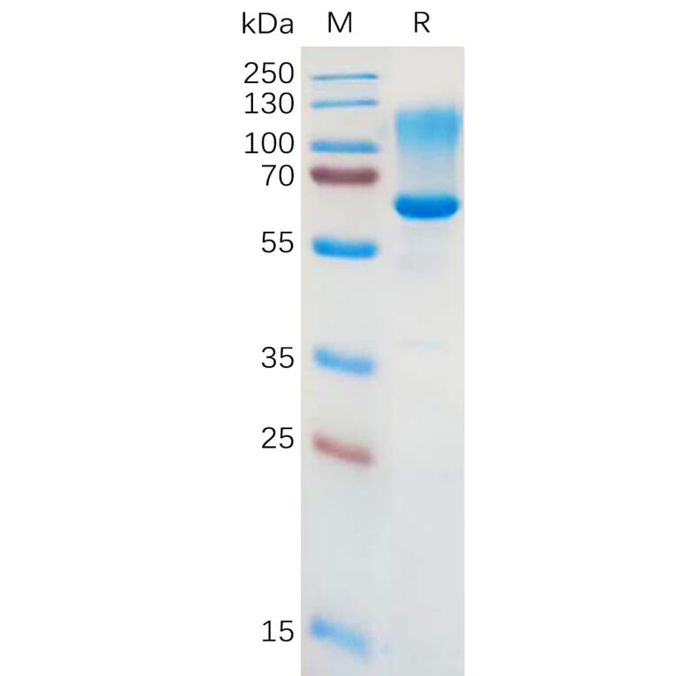 SDS-PAGE - Recombinant Human CD43 Protein (Fc Tag) (A317870) - Antibodies.com