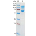 SDS-PAGE - Recombinant Human CD43 Protein (Fc Tag) (A317870) - Antibodies.com