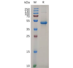 SDS-PAGE - Recombinant Human IL-20 Protein (Fc Tag) (A317871) - Antibodies.com