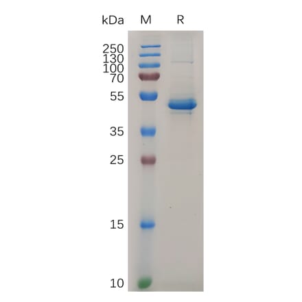 SDS-PAGE - Recombinant Human IL-20 Protein (Fc Tag) (A317871) - Antibodies.com
