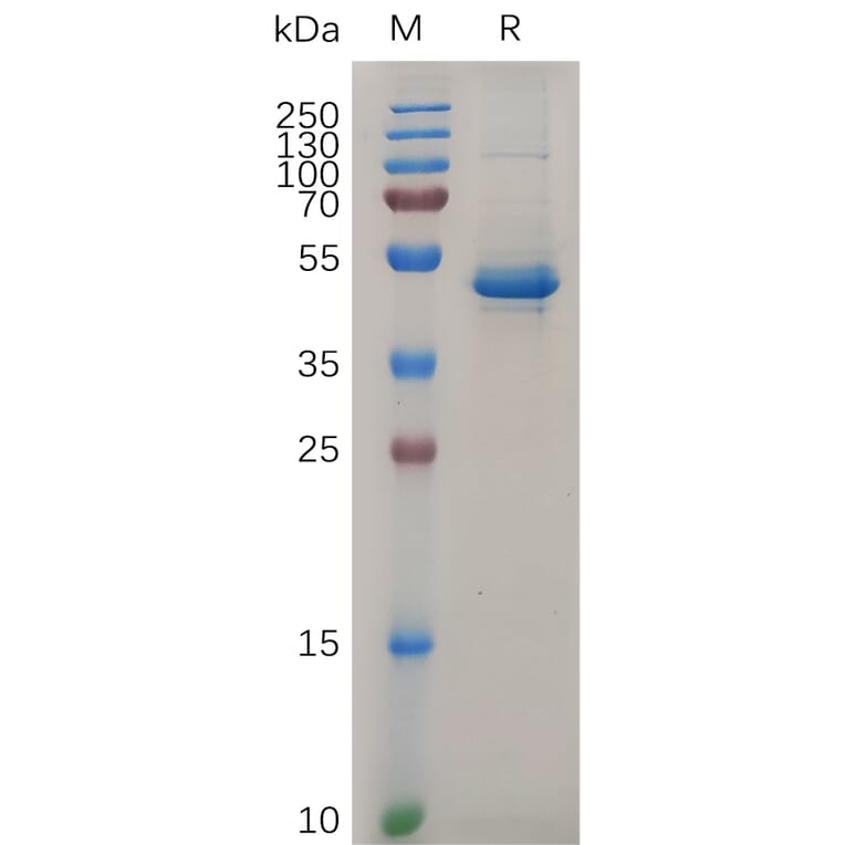 SDS-PAGE - Recombinant Human IL-20 Protein (Fc Tag) (A317871) - Antibodies.com
