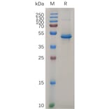 SDS-PAGE - Recombinant Human IL-20 Protein (Fc Tag) (A317871) - Antibodies.com