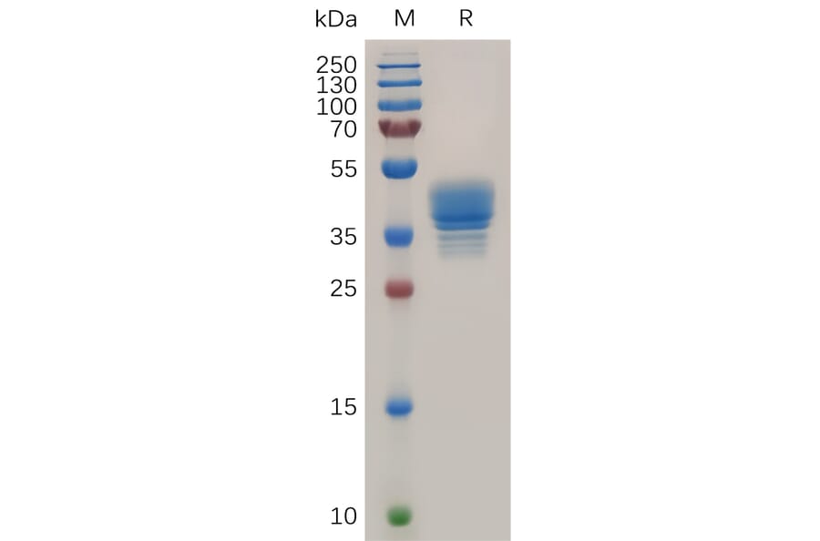 SDS-PAGE - Recombinant Human CCR3 Protein (Fc Tag) (A317872) - Antibodies.com
