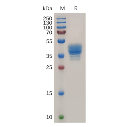 SDS-PAGE - Recombinant Human CCR3 Protein (Fc Tag) (A317872) - Antibodies.com