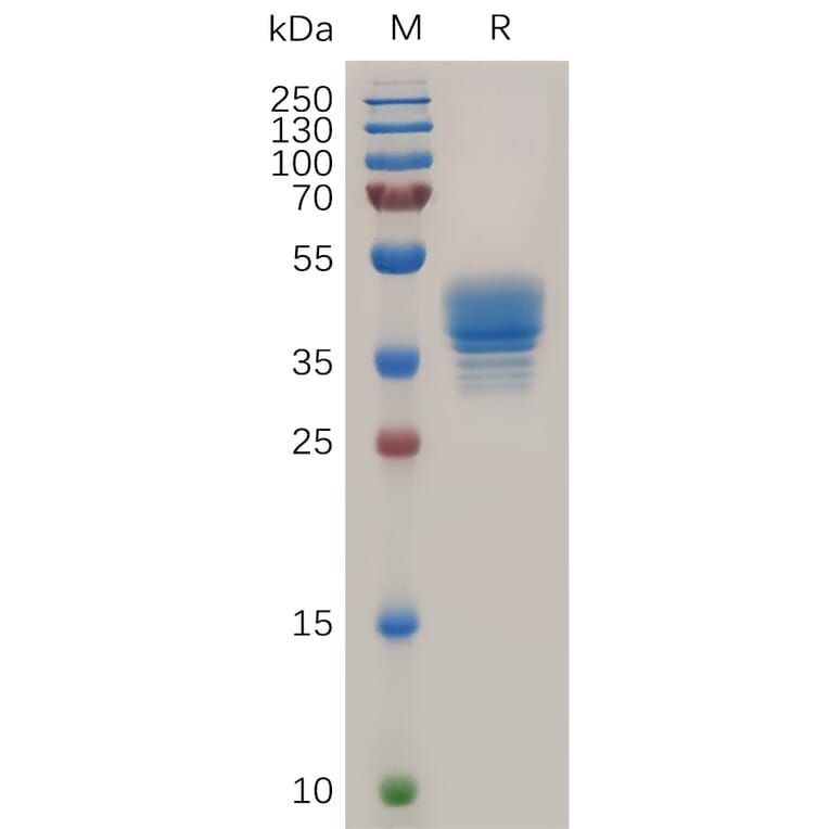 SDS-PAGE - Recombinant Human CCR3 Protein (Fc Tag) (A317872) - Antibodies.com