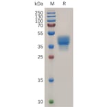 SDS-PAGE - Recombinant Human CCR3 Protein (Fc Tag) (A317872) - Antibodies.com