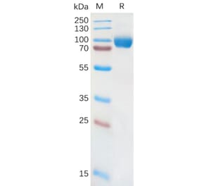 SDS-PAGE - Recombinant Human IL-18R1 Protein (Fc Tag) (A317873) - Antibodies.com