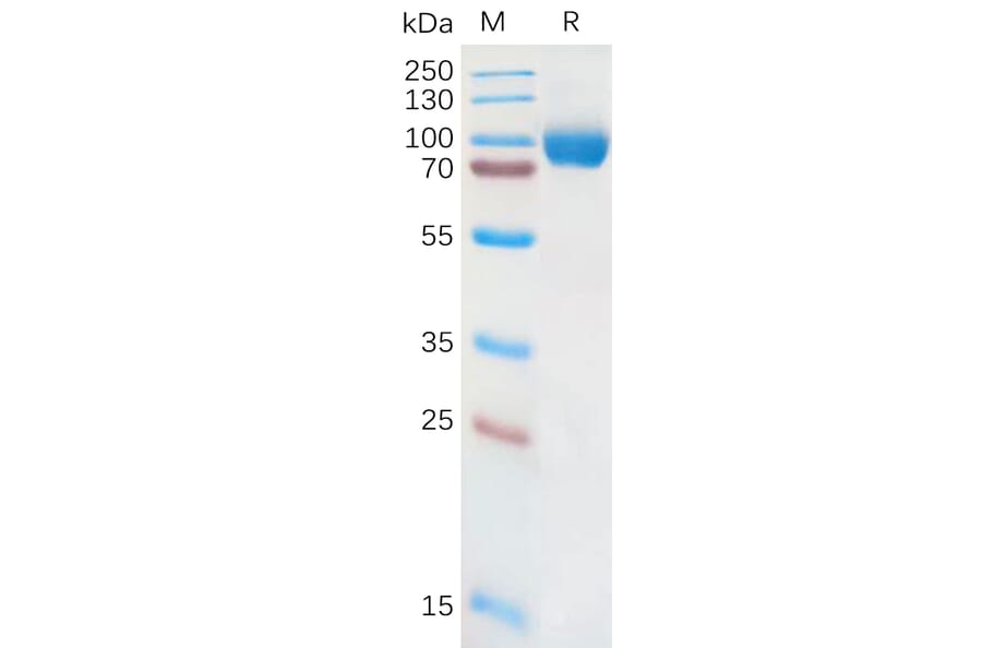 SDS-PAGE - Recombinant Human IL-18R1 Protein (Fc Tag) (A317873) - Antibodies.com