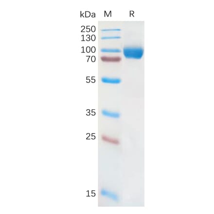 SDS-PAGE - Recombinant Human IL-18R1 Protein (Fc Tag) (A317873) - Antibodies.com