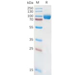 SDS-PAGE - Recombinant Human IL-18R1 Protein (Fc Tag) (A317873) - Antibodies.com