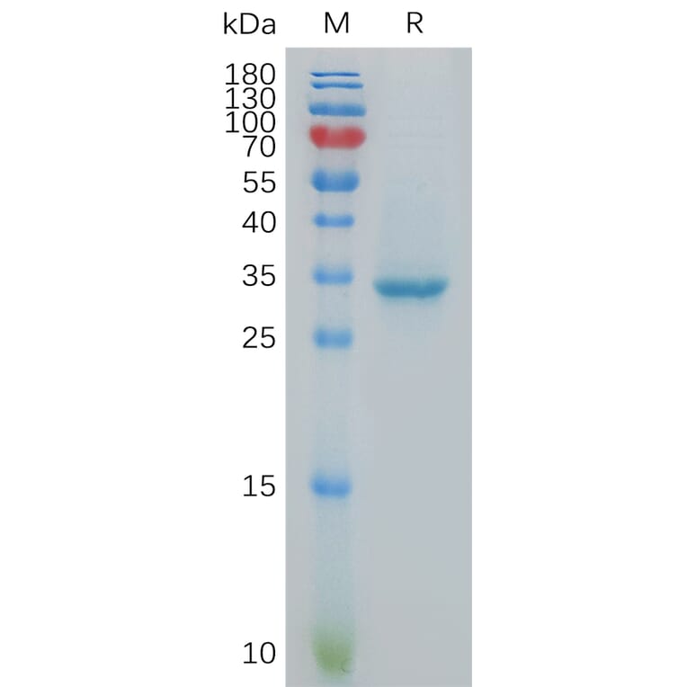 SDS-PAGE - Recombinant Human KK-LC-1 Protein (Fc Tag) (A317874) - Antibodies.com
