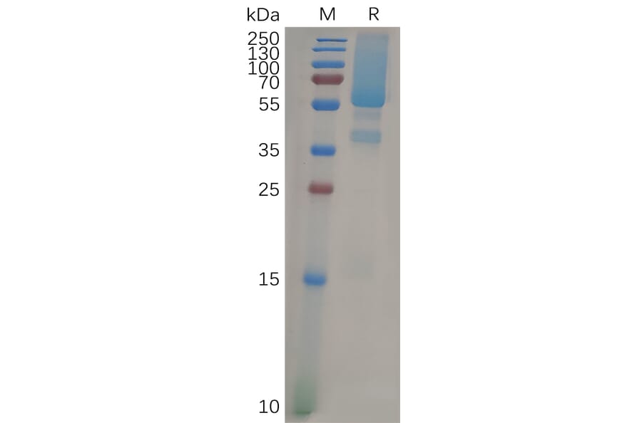 SDS-PAGE - Recombinant Human Glypican 1/GPC1 Protein (7×His Tag) (A317875) - Antibodies.com