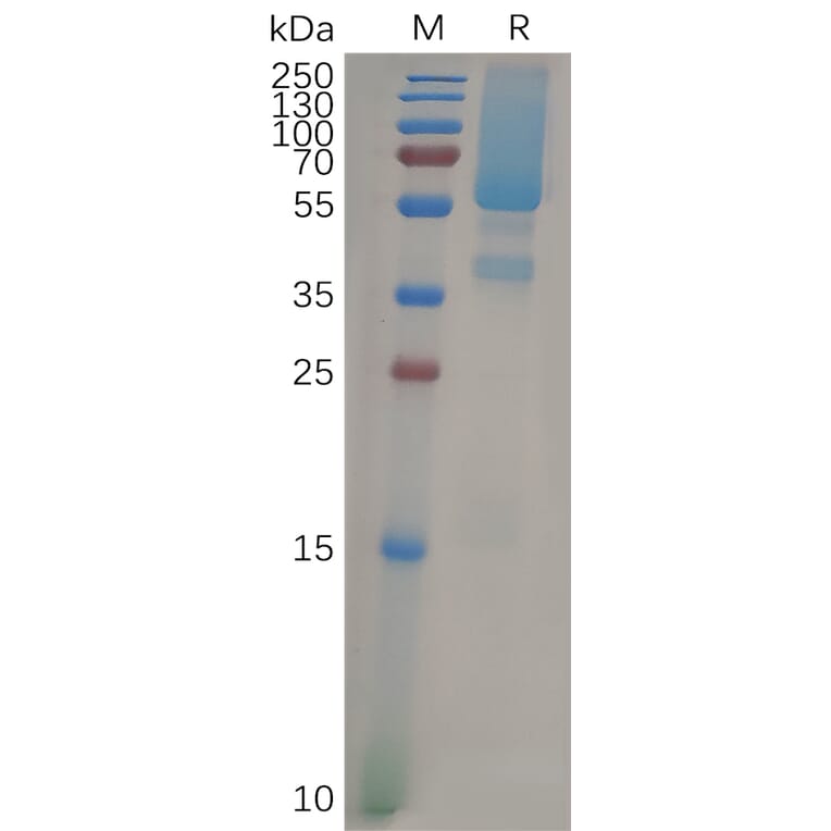 SDS-PAGE - Recombinant Human Glypican 1/GPC1 Protein (7×His Tag) (A317875) - Antibodies.com