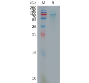 SDS-PAGE - Recombinant Human CXCL16 Protein (Fc Tag) (A317876) - Antibodies.com