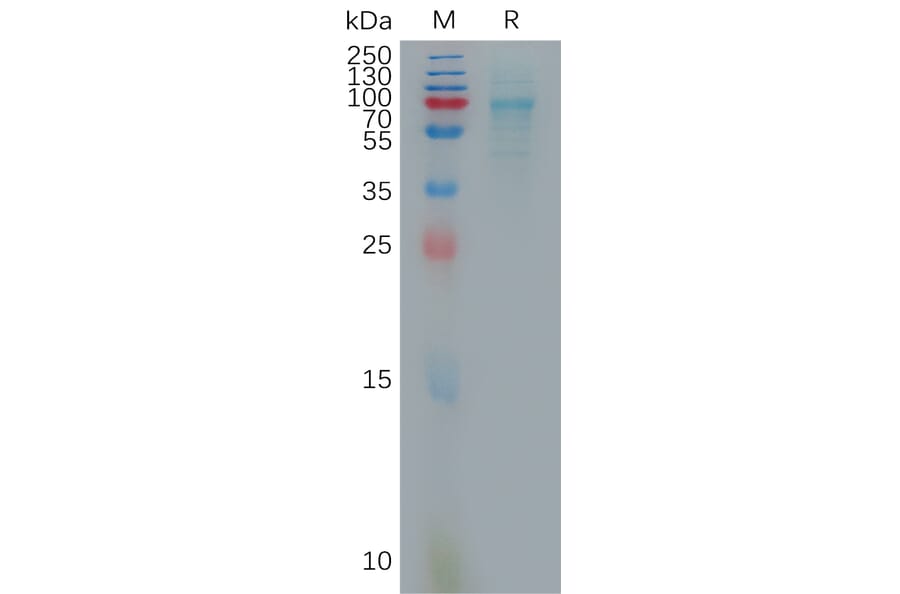 SDS-PAGE - Recombinant Human CXCL16 Protein (Fc Tag) (A317876) - Antibodies.com